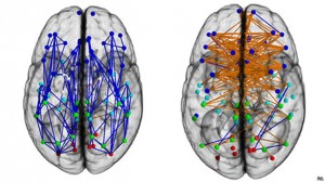 Mapa de conexiones cerebrales de hombres y mujeres.