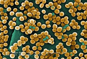Las bacterias de Staphylococcus aureus pueden ser identificadas con el biosensor de grafeno. / J. Haney Carr - CDC