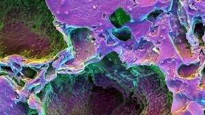 ARANY PR ET AL / Efectos del láser en las células madre: imágenes de alta resolución de imágenes de rayos X y microscopía 3D
